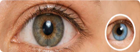 Normal Eyelid & corneal Disease