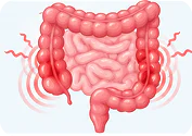 Irritable bowel syndrome (IBS)