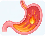 Indigestion and dyspepsia