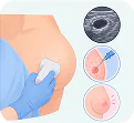 Have had a breast cyst, a biopsy, or an unusual change in the past