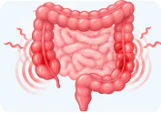 Irritable bowel syndrome (IBS)