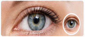 Normal eye, no dry eye disease