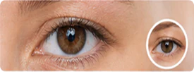 Normal Eyelid & Periocular Conditions