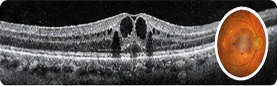 OCT & Specialist Diagnostics