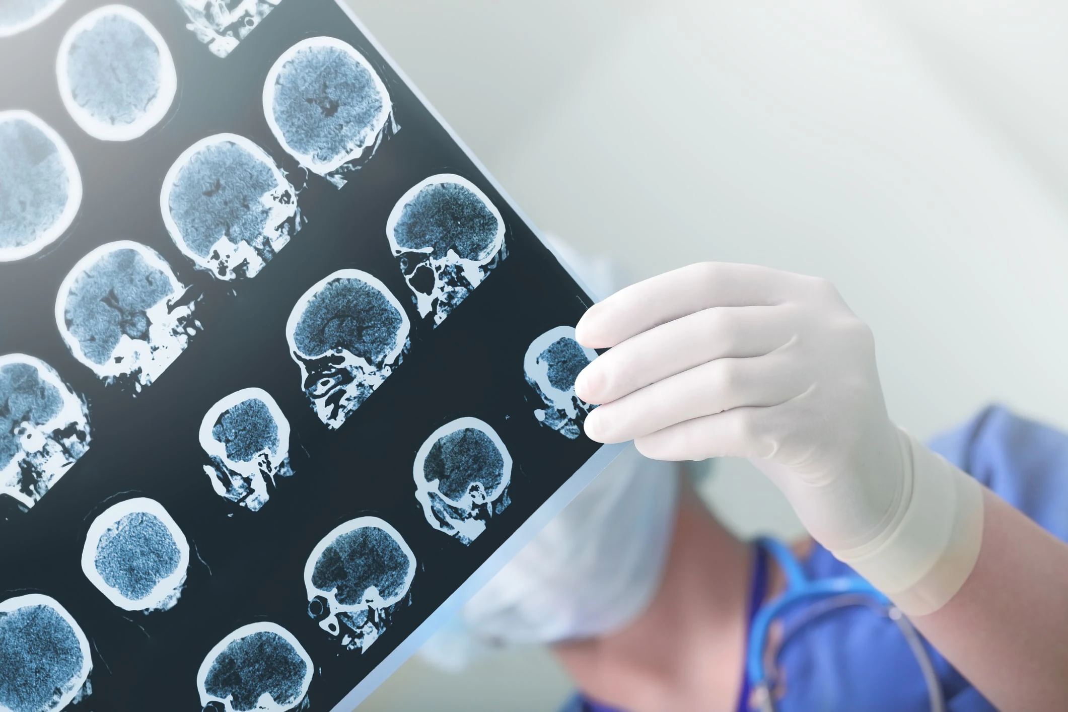 Radiologist reviewing a private brain scan at LIPS Healthcare